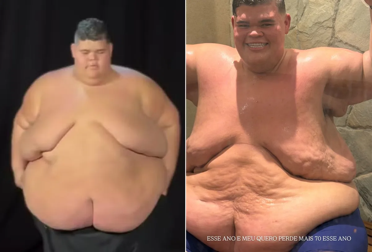 Gordão da XJ diz que quer perder mais 70 kg em 2026