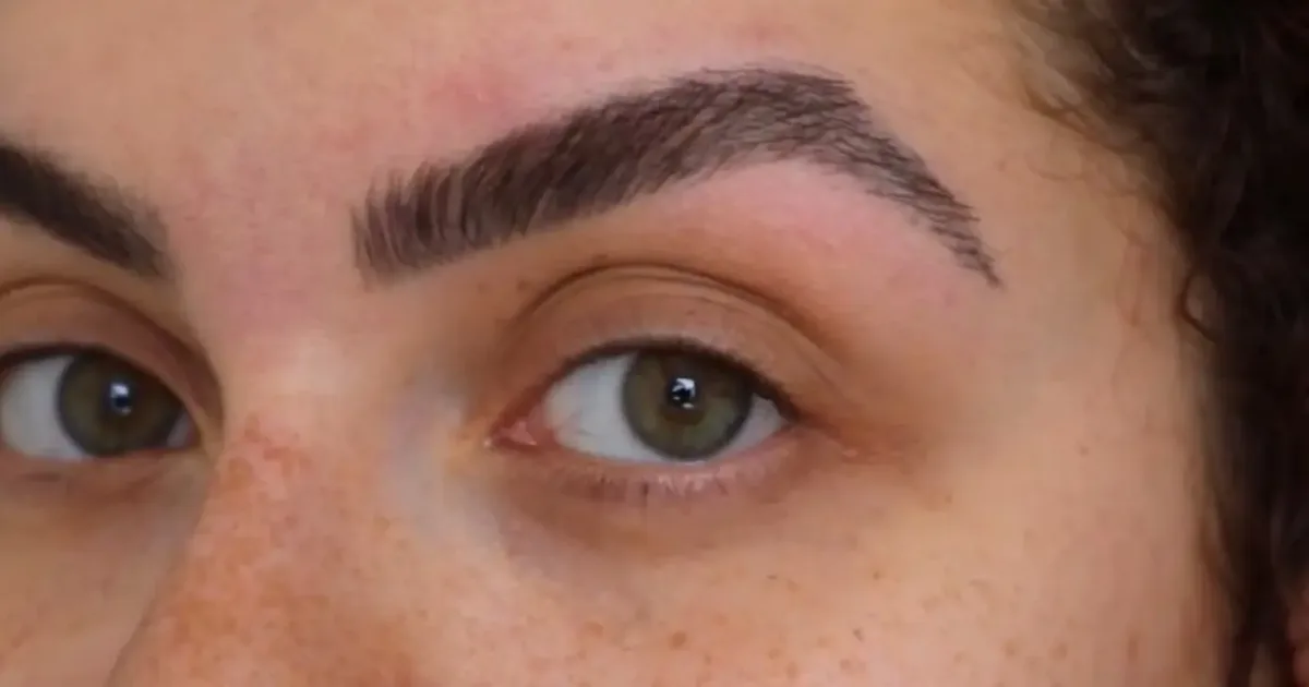 Minoxidil pode ajudar no preenchimento de sobrancelhas, mas exige orientação