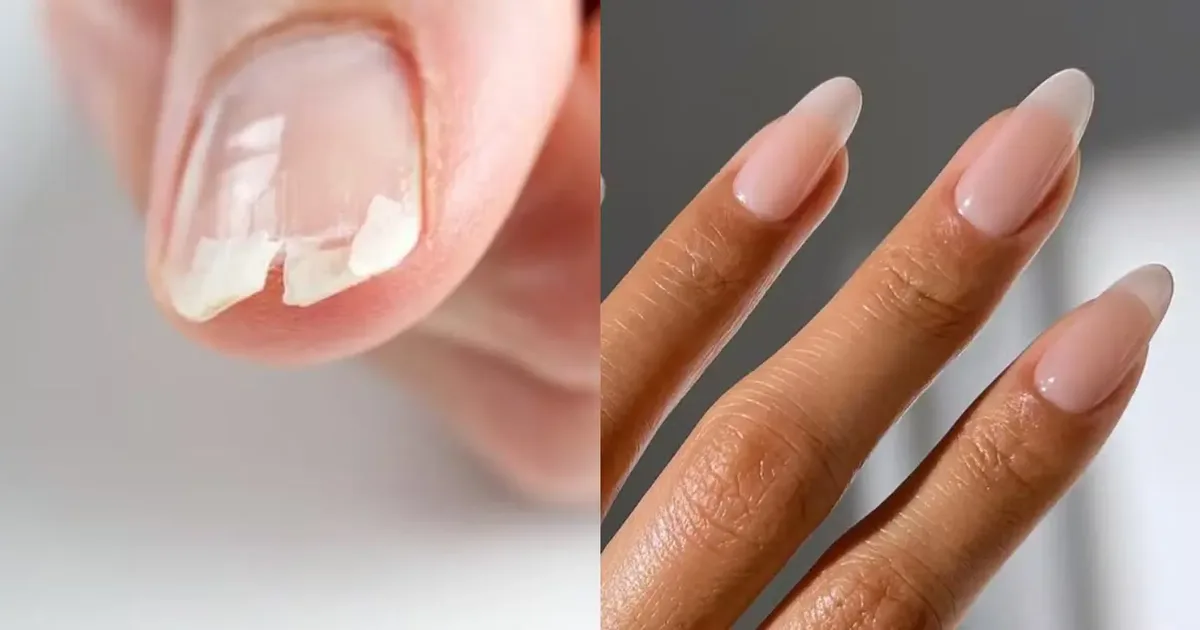 Hidratação após lavar as mãos pode ajudar a proteger unhas e cutículas