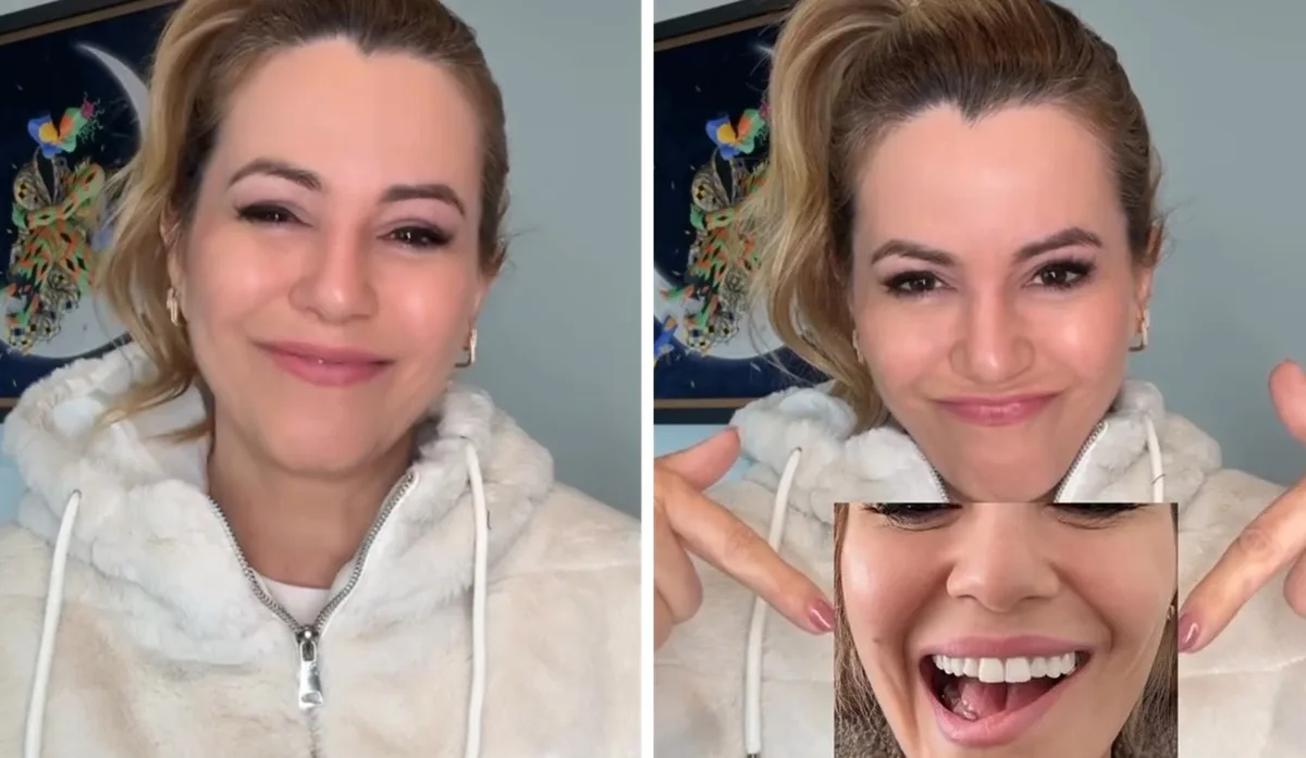Tania Oliveira conta que cirurgia no pescoço afetou o sorriso