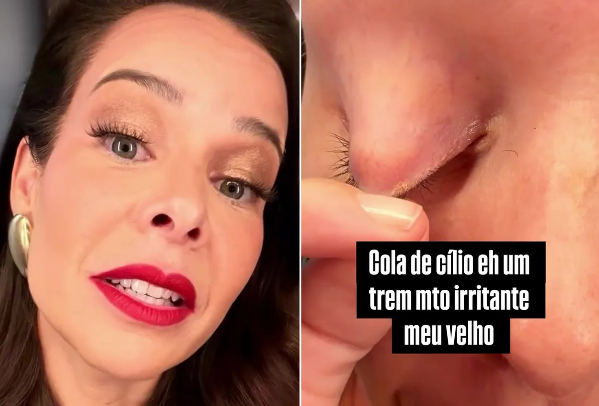 Fernanda Souza relata irritação ao remover cílios postiços depois de evento