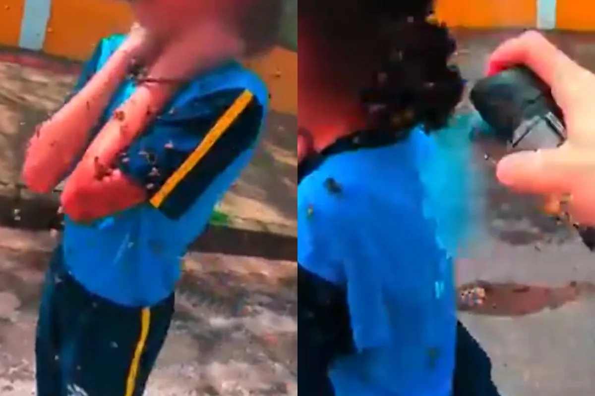 Adolescente atacada por abelhas deve deixar CTI neste sábado