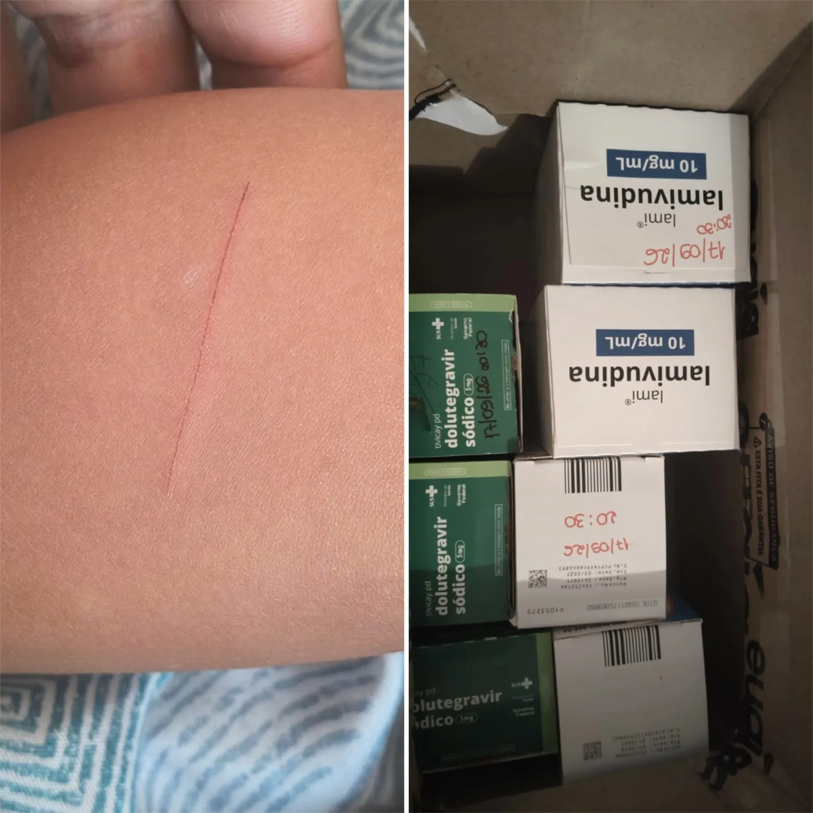 Menina de 4 anos é ferida por navalha levada por aluno em escola de Sete Lagoas