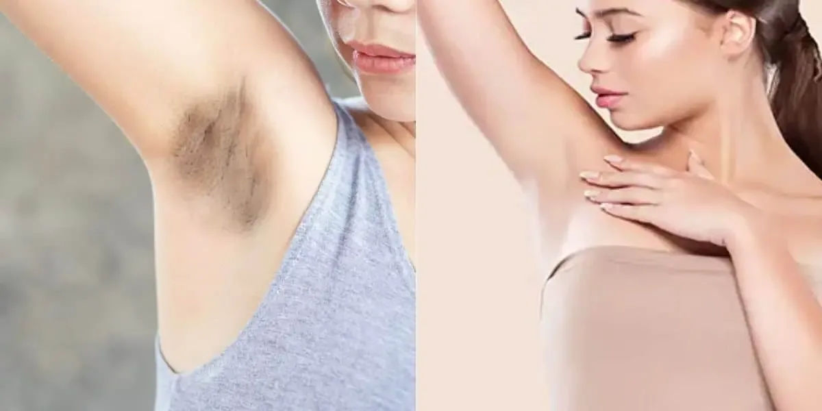 Creme da Cicatribem é divulgado para manchas em axilas e virilha