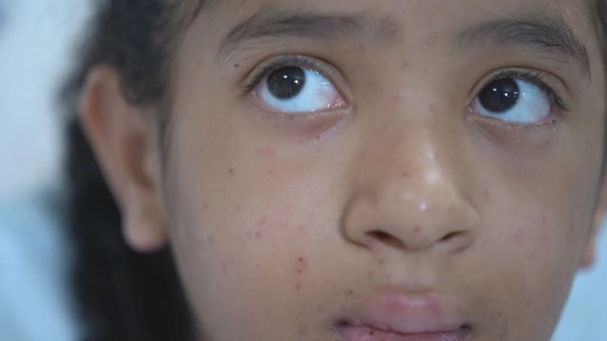 Adolescente atacada por abelhas melhora após mais de 100 picadas em Ibirité