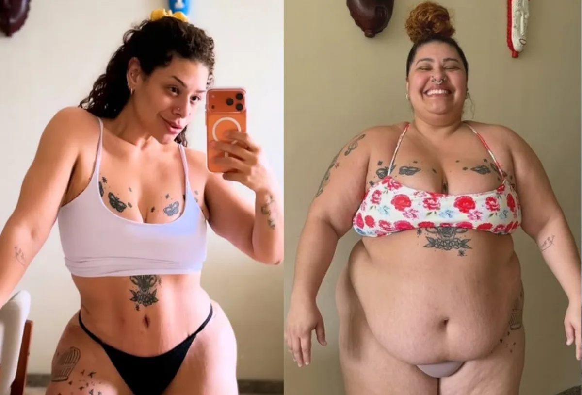 Aila Menezes mostra recuperação após abdominoplastia e perda de 90 quilos