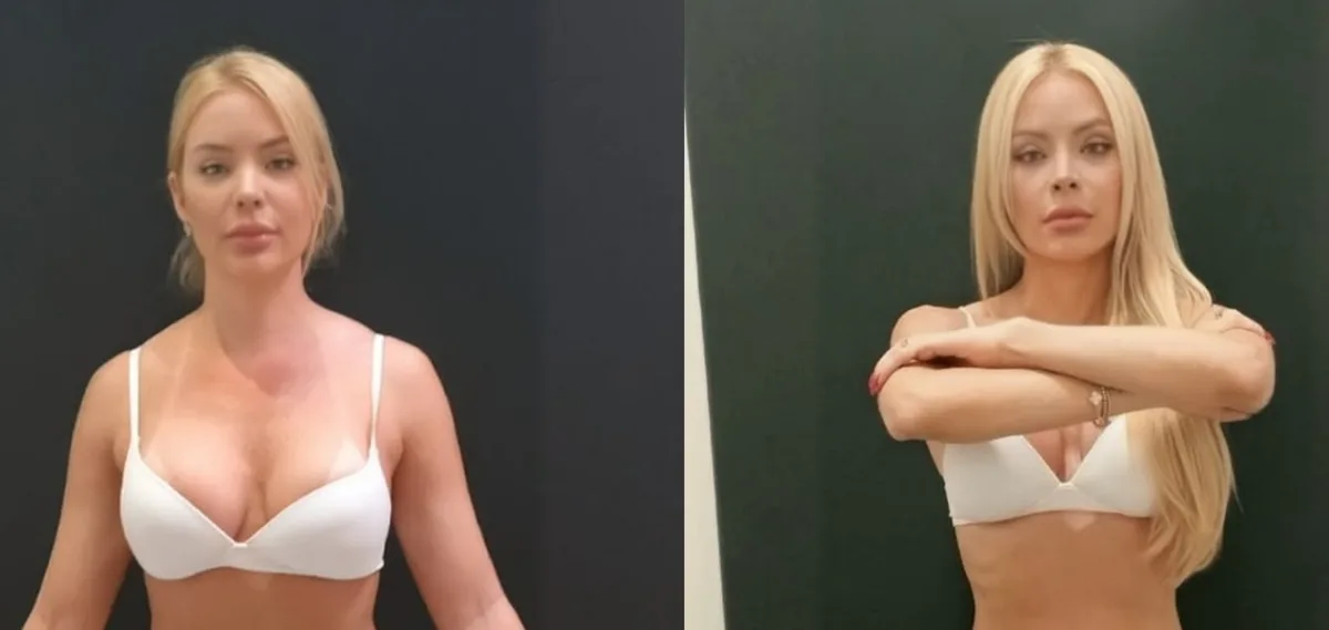 Denise Dias relaciona perda de 8,3 kg à retomada da autoestima
