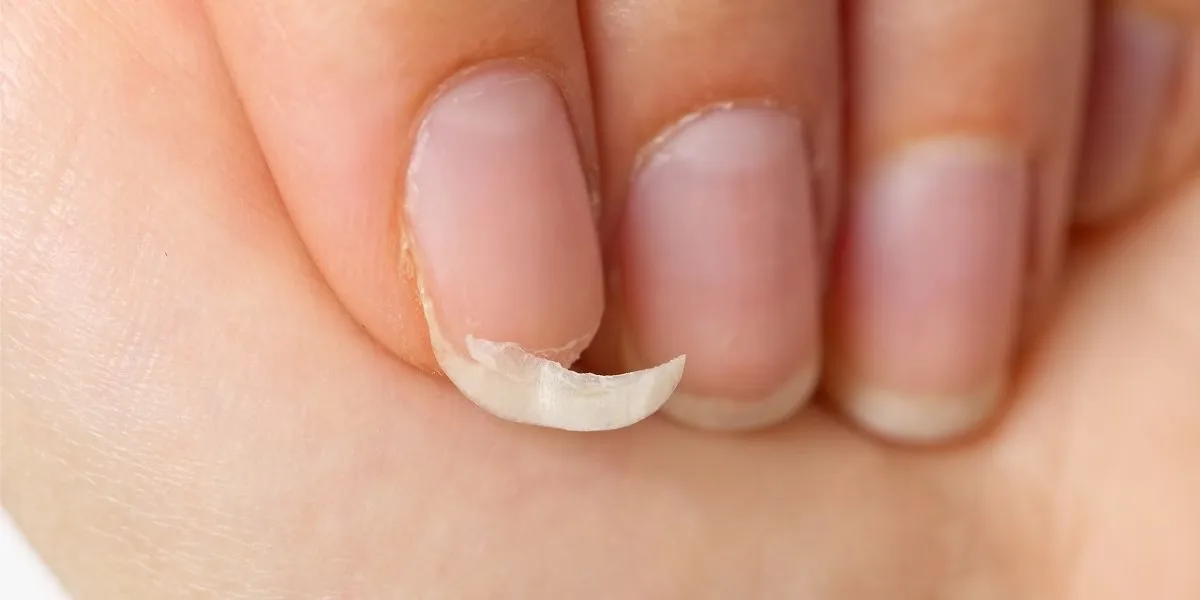 Papel e cola podem reparar unha quebrada por alguns dias