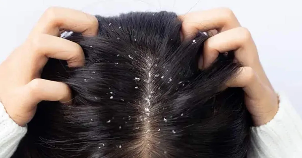 Shampoo sólido da Noviole promete controlar oleosidade e descamação